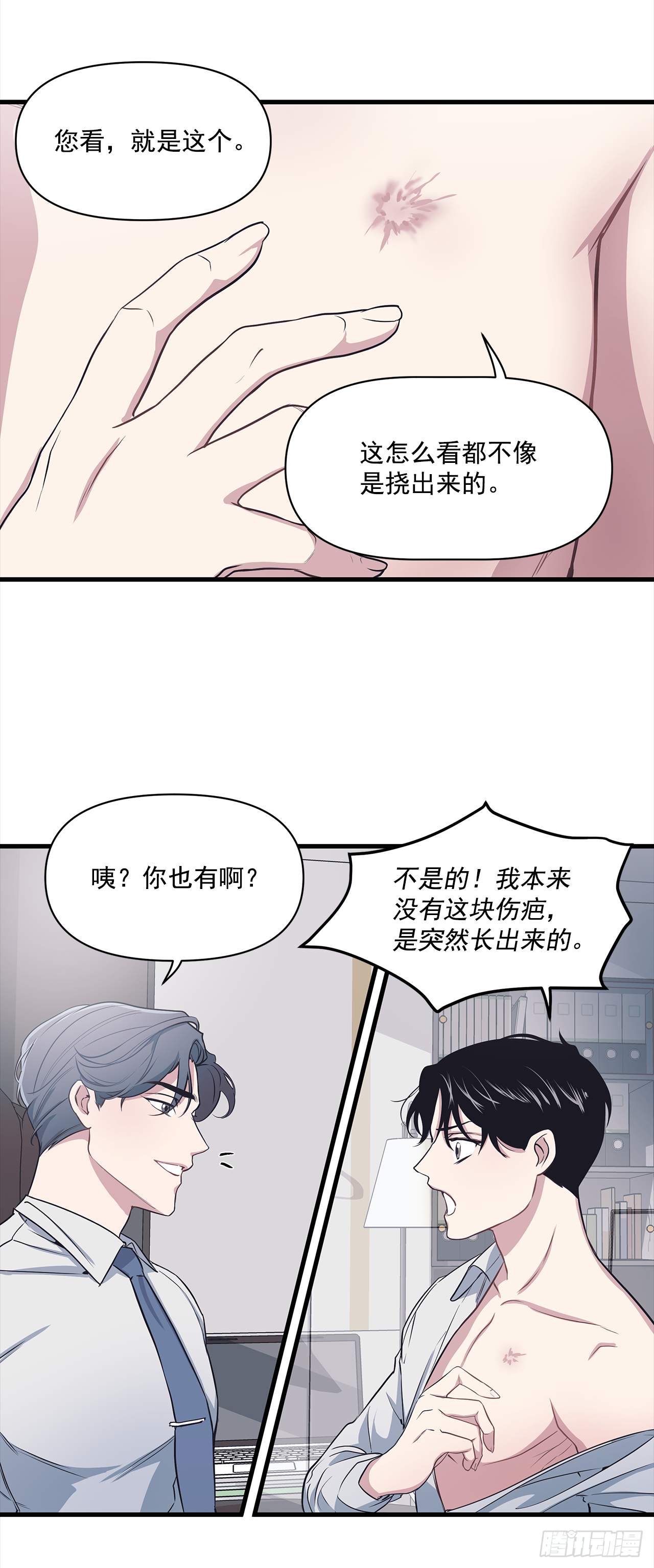 3.伤疤 第34页