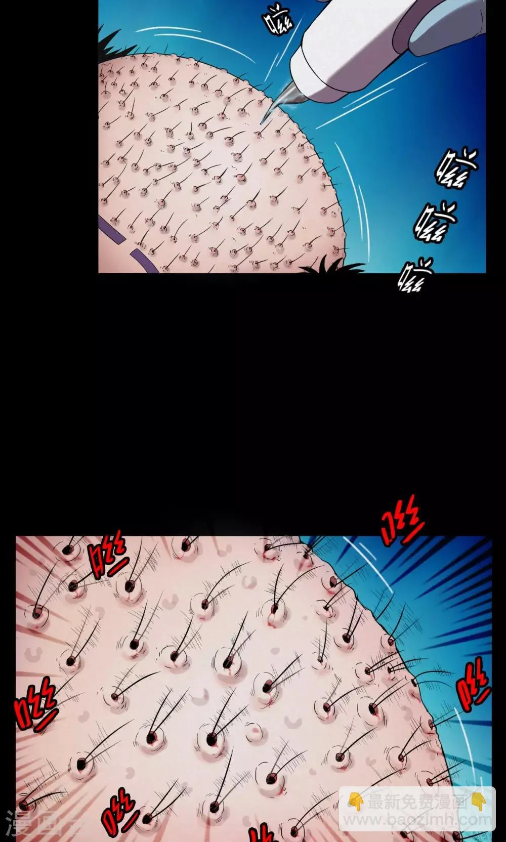 第19话 植发4 第4页