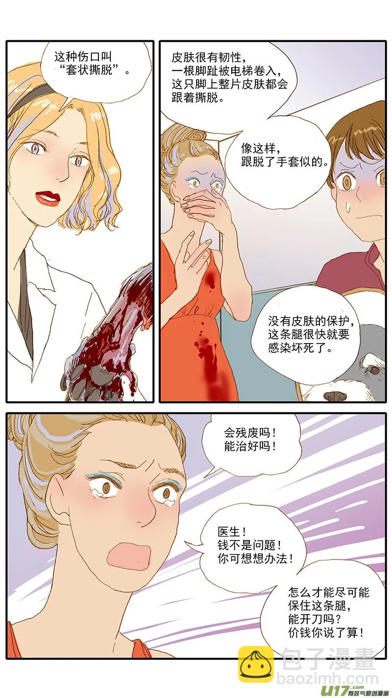 115 袖套状撕脱（管形皮瓣术） 第4页