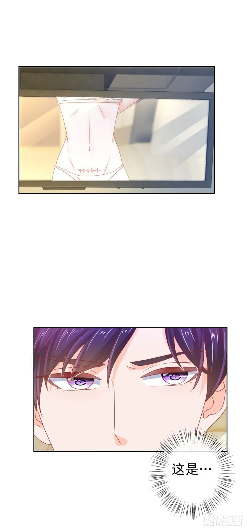 第139话 肚子上的疤痕 第25页