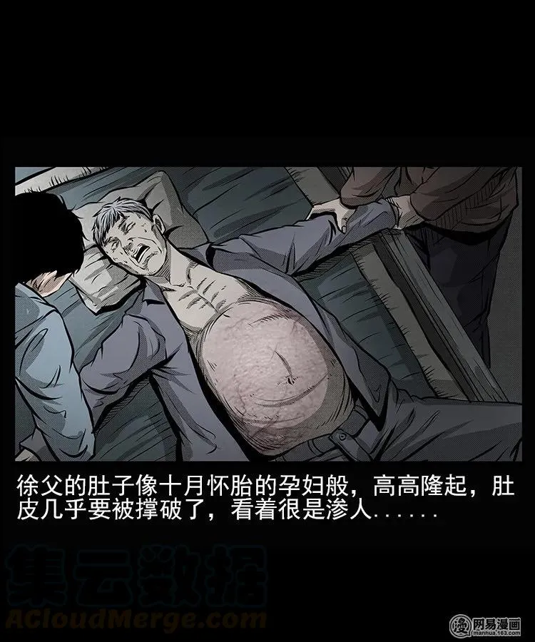66 赤脚医生破蛊（上） 第21页