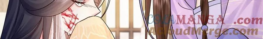 174 毁容 第73页