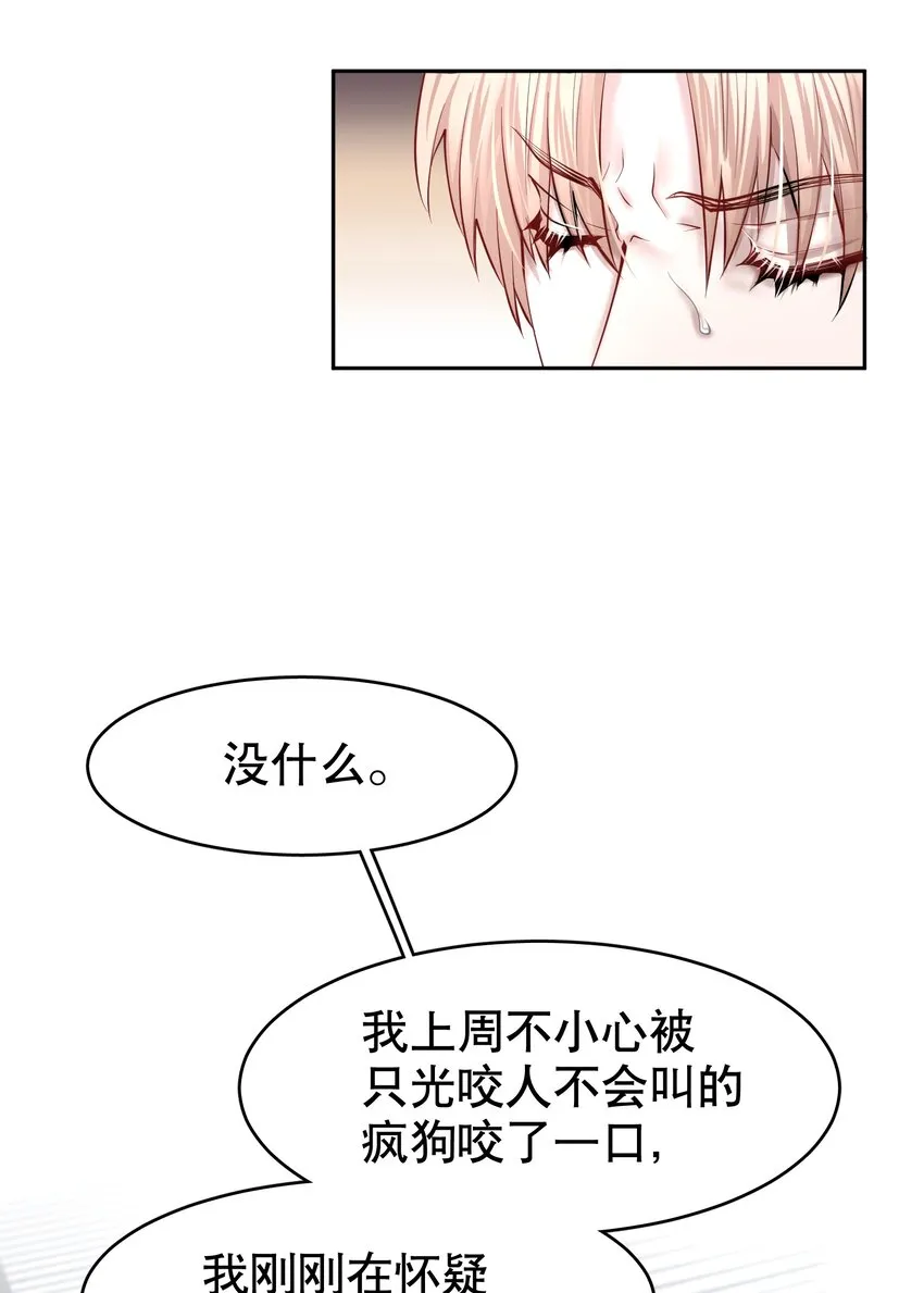 第33章 疯狗咬了一口 第29页