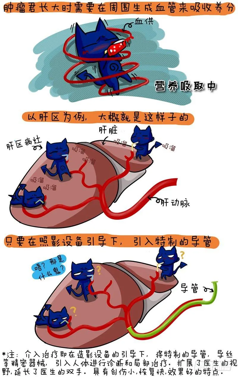 第44话 肝介入手术 第2页