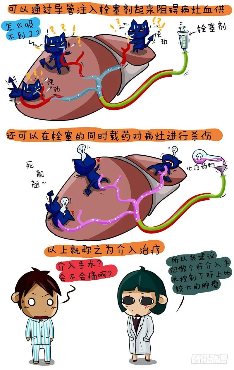 第44话 肝介入手术 第3页