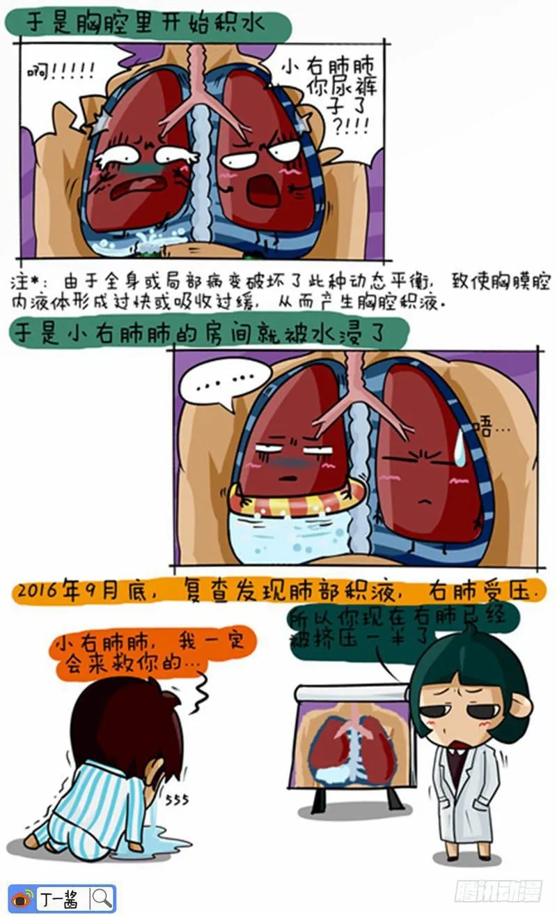 第46话 胸腔积水 第3页